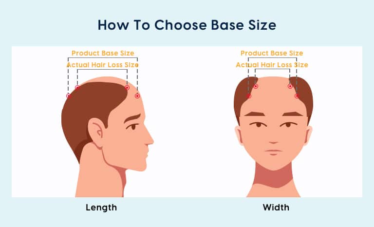 V-looped Thin Skin Base Hair System For Men